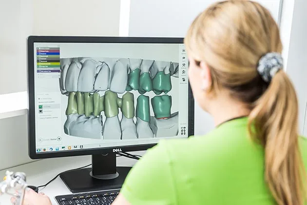 Implantat-Modellierung am Computer